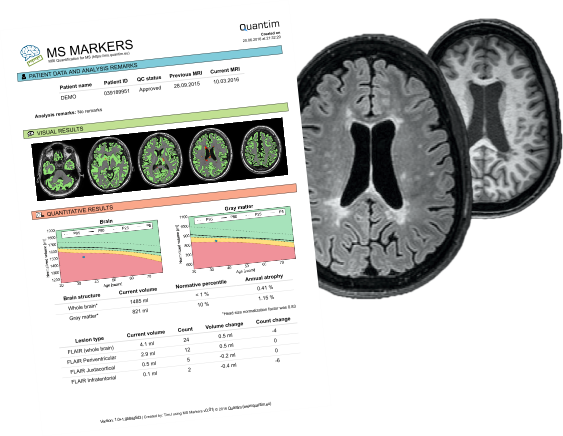 Lesion and brain atrophy measurements for monitoring of Multiple Sclerosis