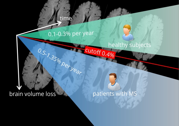 Monitor brain volume loss using MS Markers
