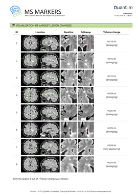 MS Markers sample report